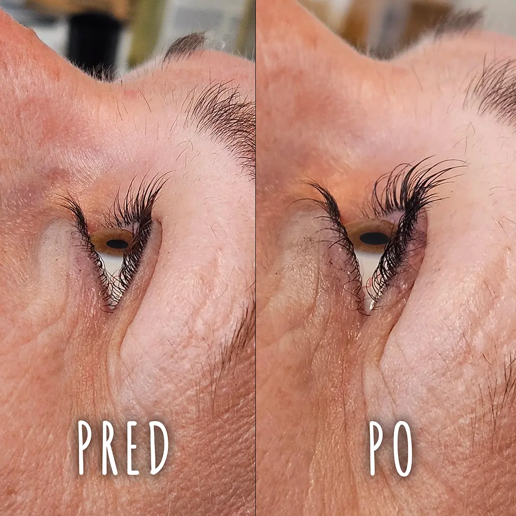 Lashlift